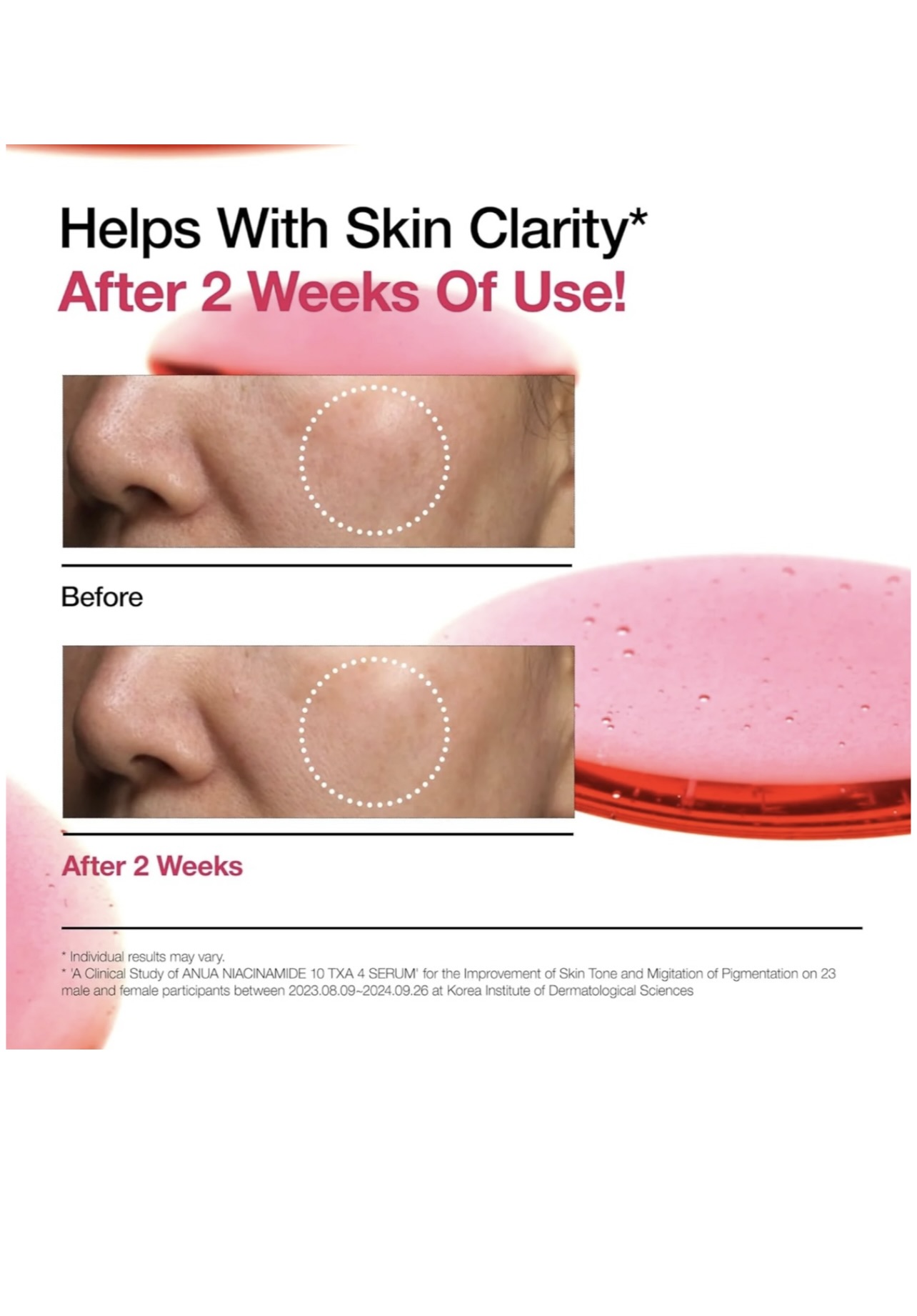 Anua Niacinamide 10%+ TXA 4% Dark Spot Brightening Glow Serum For GlassSkin - Image 4