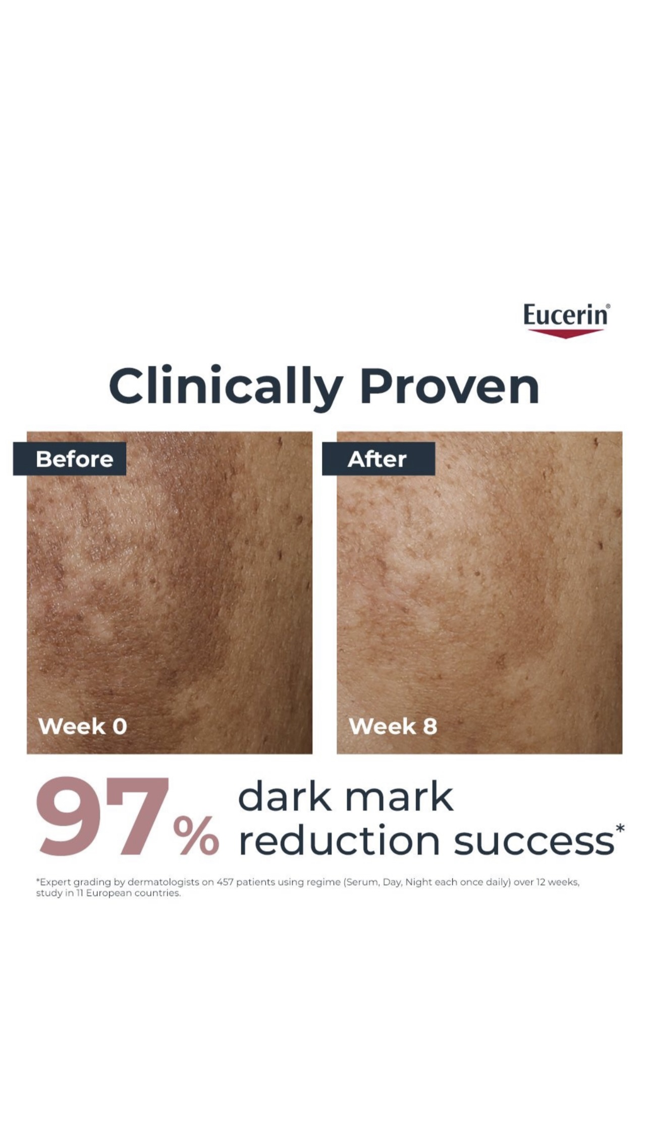 Eucerin Even Pigment Perfector Face Day Cream, SPF 30, for Dark Marks, 50ml - Image 7